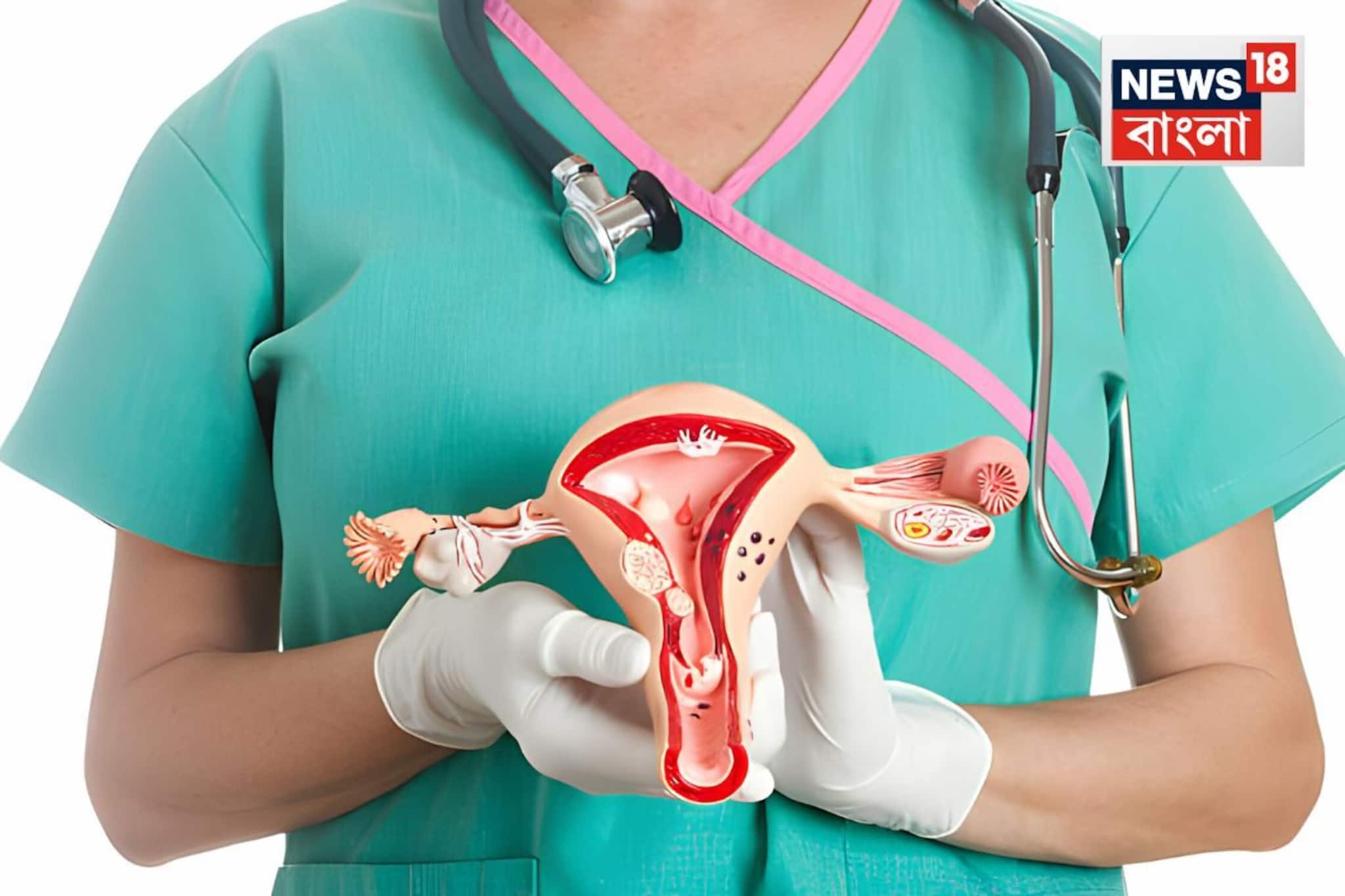 যৌ*ন সম্পর্কের পরে এই একটা লক্ষণ...হতে পারে সার্ভিক্যাল ক্যানসারের প্রাথমিক symptom