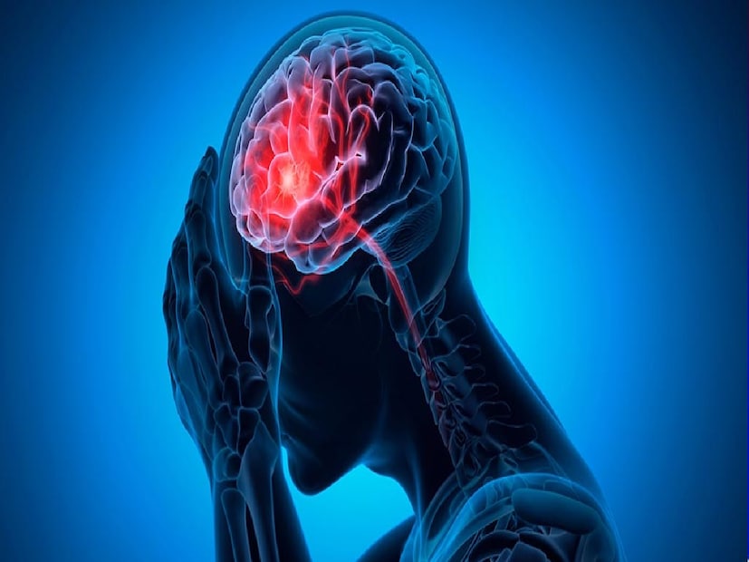 *হার্ট অ্যাটাকের পর মৃত্যুর দ্বিতীয় প্রধান কারণ হল স্ট্রোক। একে পক্ষাঘাত বলা হয়। স্ট্রোক হল এমন একটি চিকিৎসা অবস্থা, যেখানে মস্তিষ্কে রক্ত প্রবাহ হঠাৎ বন্ধ হয়ে যায়। ফলে মস্তিষ্ক তার অক্সিজেন এবং পুষ্টি হারাতে থাকে। সময়মতো চিকিৎসা না করালে মস্তিষ্কের কোষ ক্ষতিগ্রস্ত হতে পারে এমনকি মারাও যেতে পারে। তবে, কিছু লক্ষণের মাধ্যমে এই রোগটি প্রাথমিক পর্যায়ে শনাক্ত করা যেতে পারে। সংগৃহীত ছবি। *হার্ট অ্যাটাকের পর মৃত্যুর দ্বিতীয় প্রধান কারণ হল স্ট্রোক। একে পক্ষাঘাত বলা হয়। স্ট্রোক হল এমন একটি চিকিৎসা অবস্থা, যেখানে মস্তিষ্কে রক্ত প্রবাহ হঠাৎ বন্ধ হয়ে যায়। ফলে মস্তিষ্ক তার অক্সিজেন এবং পুষ্টি হারাতে থাকে। সময়মতো চিকিৎসা না করালে মস্তিষ্কের কোষ ক্ষতিগ্রস্ত হতে পারে এমনকি মারাও যেতে পারে। তবে, কিছু লক্ষণের মাধ্যমে এই রোগটি প্রাথমিক পর্যায়ে শনাক্ত করা যেতে পারে। সংগৃহীত ছবি।