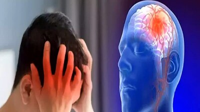 *ডাক্তাররা স্ট্রোক সনাক্ত করার জন্য FAST পরীক্ষার পরামর্শ দেন। F (মুখ)- মুখ কি বিকৃত হয়েছে? A (বাহু): এক হাত তুলতে কি অসুবিধা হচ্ছে? S (বক্তৃতা): কথা বলতে কি ঝাপসা হয়ে যাচ্ছে? নাকি কথা বলতে অসুবিধা হচ্ছে? T (সময়): যদি উপরের কোনও লক্ষণ দেখা দেয়, তাহলে বিলম্ব না করে অবিলম্বে জরুরি চিকিৎসা দেওয়া উচিত। সংগৃহীত ছবি। 