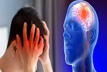 Mini Stroke: হাত-পা অবশ, কথা জড়িয়ে যাচ্ছে? 'মিনি-স্ট্রোক'-এ শরীর ঝাঁঝরা হচ্ছে না তো? কী বলছেন চিকিৎসক? জানলে আঁতকে উঠবেন