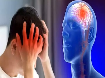 হাত-পা অবশ, কথা জড়িয়ে যাচ্ছে? 'মিনি-স্ট্রোক'-এ শরীর ঝাঁঝরা হচ্ছে না তো? কী বলছেন চিকিৎসক