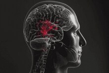 Stroke: সকালে শরীরে 'এই' লক্ষণগুলি দেখলে সাবধান...! ব্রেন স্ট্রোক হতে পারে, আচমকা প্যারালাইসিসে শয্যাশায়ী হতে পারেন