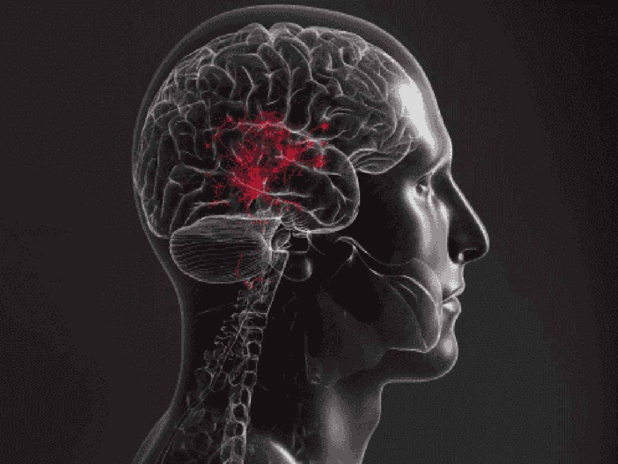 সকালে শরীরে 'এই' লক্ষণ দেখলে সাবধান!ব্রেন স্ট্রোক হতে পারে, প্যারালাইসিসে শয্যাশায়ী শরীর