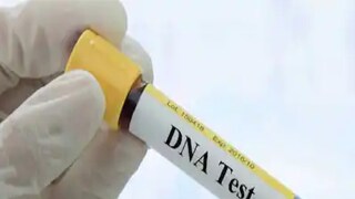 ডিএনএ টেস্ট করাতে গিয়ে সামনে এল এ কী খবর 