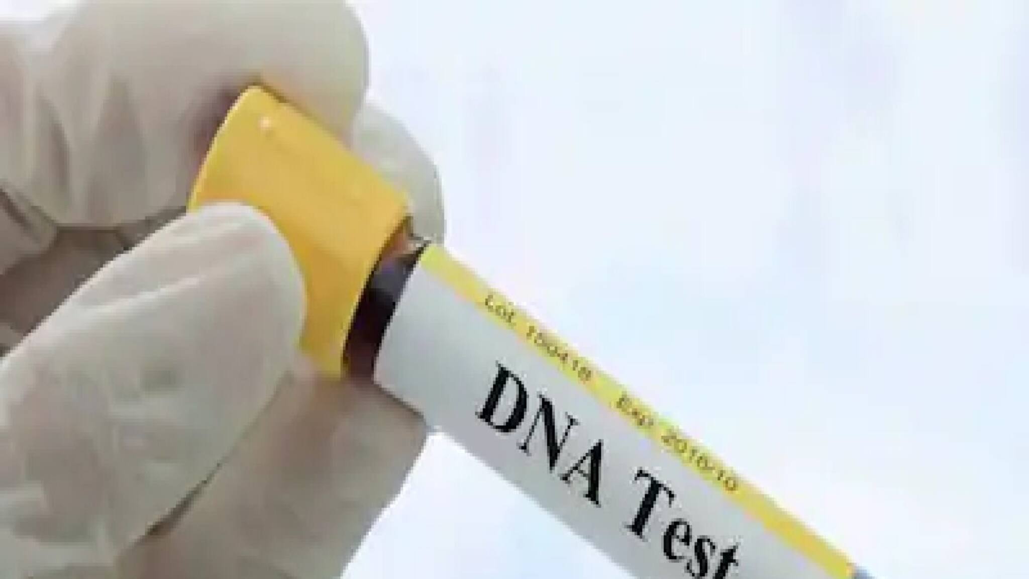 DNA Test: মজার ছলেই করতে গিয়েছিল ডিএনএ পরীক্ষা, পুরো পৃথিবী ভেঙে পড়ল মাথার ওপর