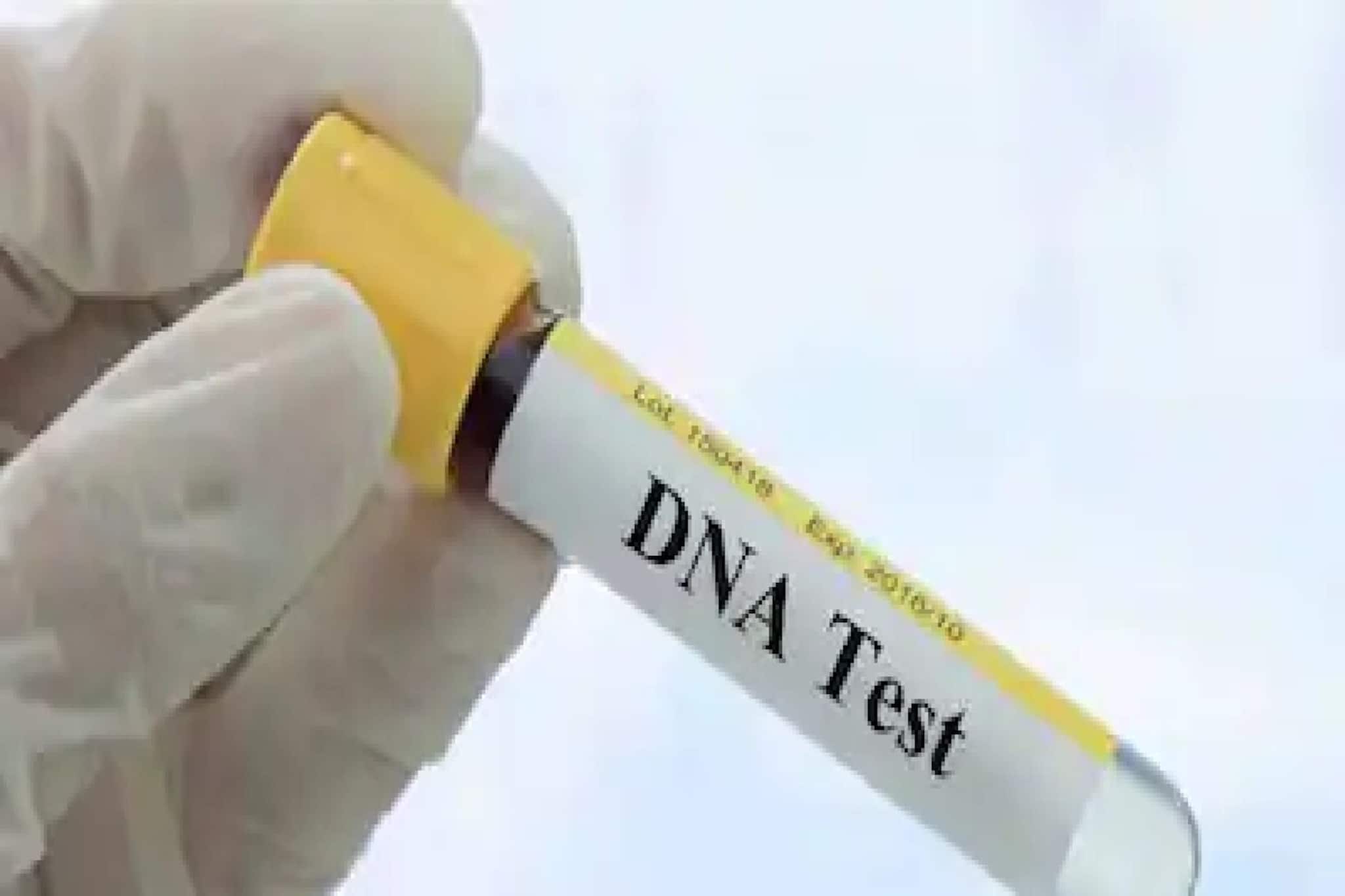 DNA Test: মজার ছলেই করতে গিয়েছিল ডিএনএ পরীক্ষা, পুরো পৃথিবী ভেঙে পড়ল মাথার ওপর