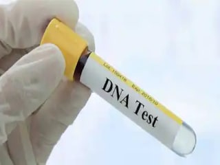 ডিএনএ টেস্ট করাতে গিয়ে সামনে এল এ কী খবর 