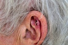 Detect Ear Cancer: কানে ব্যথা মানেই ঠান্ডা লাগেনি! হতেই পারে 'বিরল' কানের ক্যানসার...! 'এই' লক্ষণগুলির একটিও থাকলে সাবধান