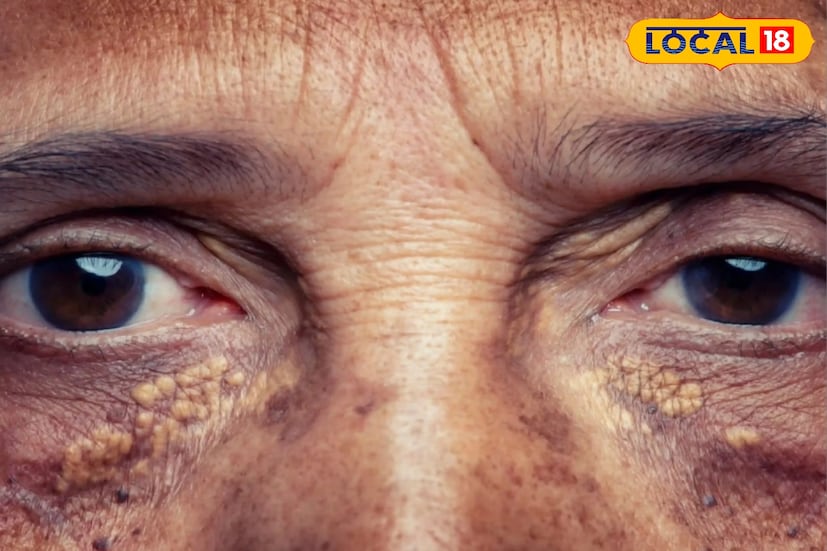 *মানব শরীরে মূলত দুই ধরনের কোলেস্টেরল থাকে, এলডিএল (LDL) বা খারাপ কোলেস্টেরল এবং এইচডিএল (HDL) বা ভাল কোলেস্টেরল। এই দুইয়ের ভারসাম্য বজায় থাকলে শরীর সুস্থ থাকে। তবে খারাপ কোলেস্টেরলের মাত্রা বেড়ে গেলে হৃদ্‌রোগ, স্ট্রোক-সহ নানা জটিলতার ঝুঁকি বাড়ে।