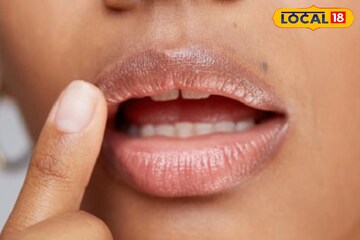 ঠোঁটের রঙেই ধরা পড়ে শরীরের গোপন অসুখ! কী দেখে বুঝবেন, রইল জানার উপায়