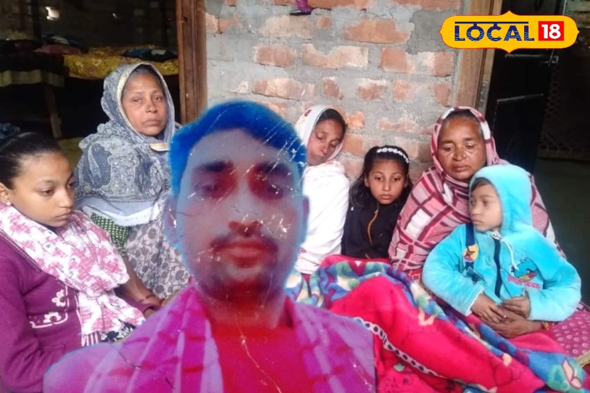 ভিন রাজ্যে দুর্ঘটনার কবলে বাংলার পরিযায়ী শ্রমিক, টাকার অভাবে বন্ধ চিকিৎসা! সাহায্য দাবি ভিন রাজ্যে দুর্ঘটনার কবলে বাংলার পরিযায়ী শ্রমিক, টাকার অভাবে বন্ধ চিকিৎসা! সাহায্য দাবি