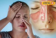 Fight Sinusitis: শীতে সাইনাসের সমস্যা বেড়েছে ? গাদাগাদা ওষুধ নয়,সহজ ঘরোয়া উপায়ে আরাম পান