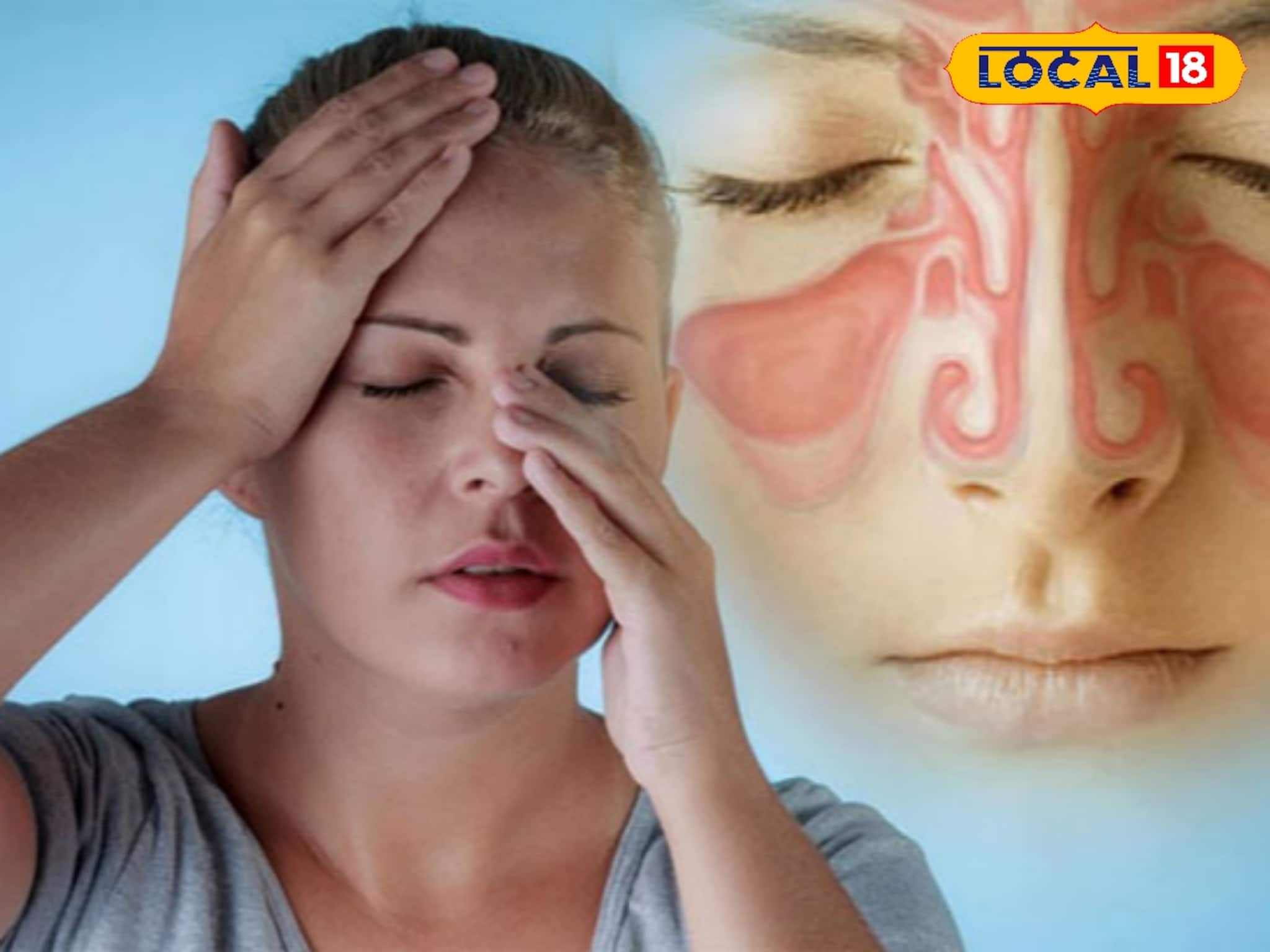 শীতে সাইনাসের সমস্যা বেড়েছে ? গাদাগাদা ওষুধ নয়,সহজ ঘরোয়া উপায়ে আরাম পান