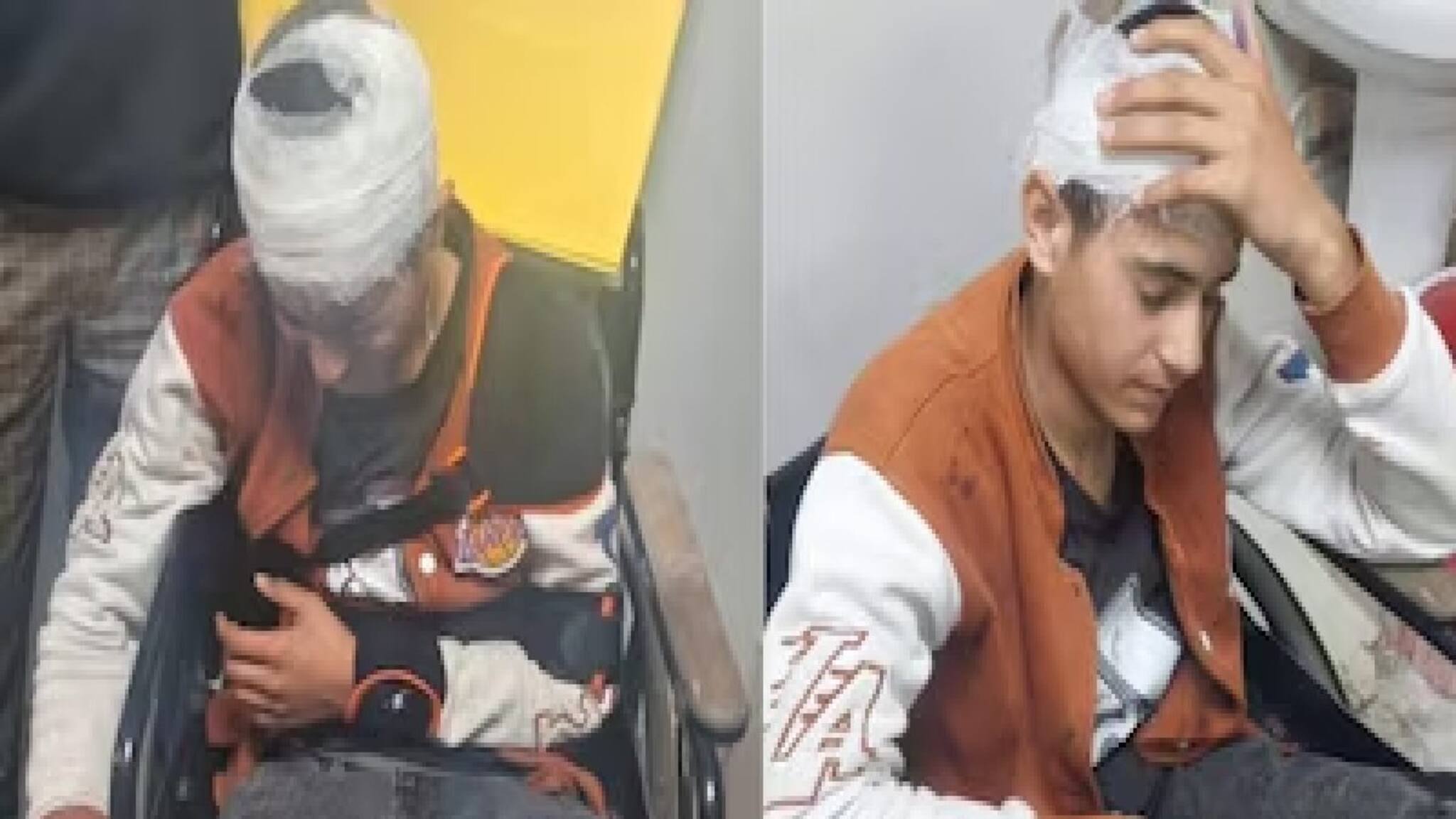 Kashmiri Vendor Attacked: লোহার রড দিয়ে বেধড়ক মার, উত্তরাখণ্ডে আক্রান্ত ১৮ বছরের কাশ্মীরী যুবক! নিন্দা মুখ্যমন্ত্রী ওমরের