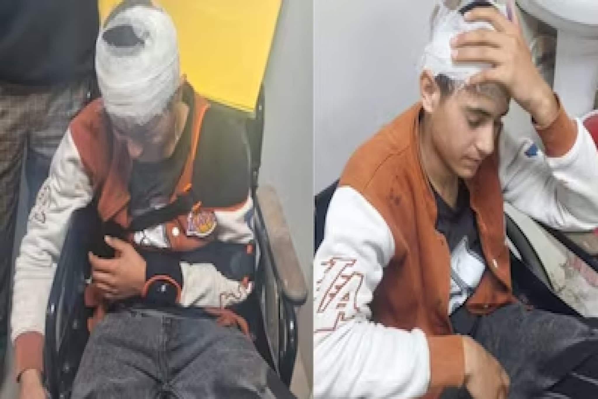 লোহার রড দিয়ে বেধড়ক মার, উত্তরাখণ্ডে আক্রান্ত ১৮-র কাশ্মীরী যুবক! নিন্দা মুখ্যমন্ত্রীর লোহার রড দিয়ে বেধড়ক মার, উত্তরাখণ্ডে আক্রান্ত ১৮-র কাশ্মীরী যুবক! নিন্দা মুখ্যমন্ত্রীর