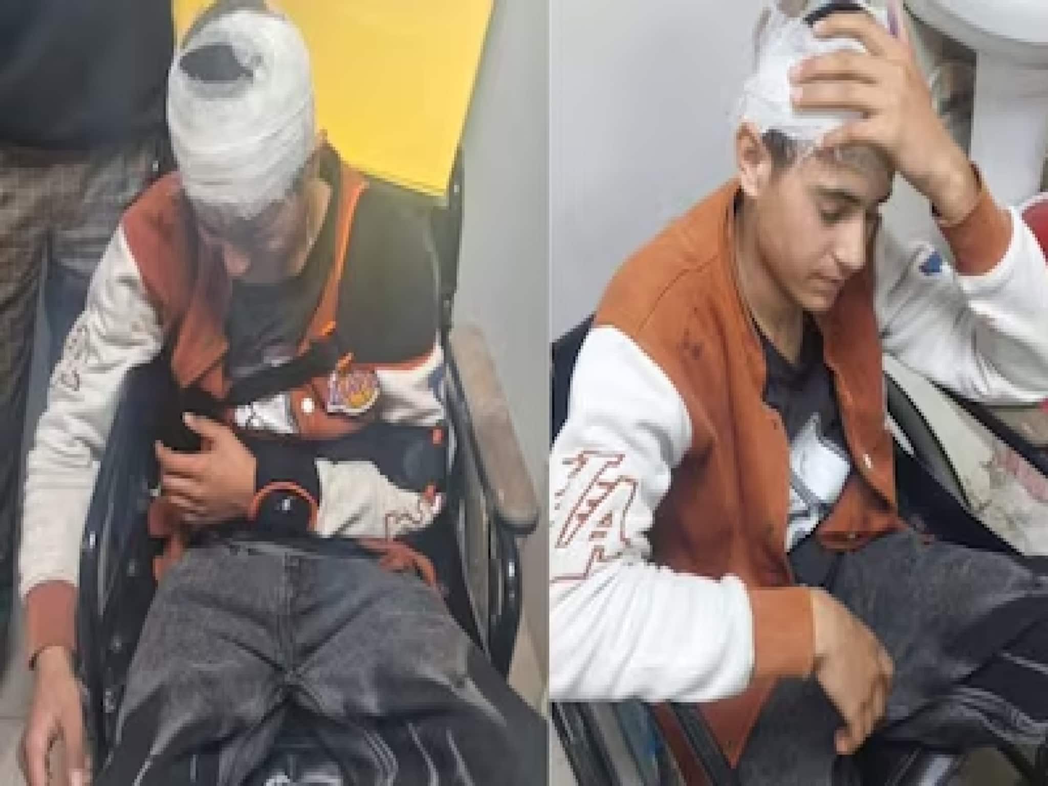 লোহার রড দিয়ে বেধড়ক মার, উত্তরাখণ্ডে আক্রান্ত ১৮-র কাশ্মীরী যুবক! নিন্দা মুখ্যমন্ত্রীর লোহার রড দিয়ে বেধড়ক মার, উত্তরাখণ্ডে আক্রান্ত ১৮-র কাশ্মীরী যুবক! নিন্দা মুখ্যমন্ত্রীর