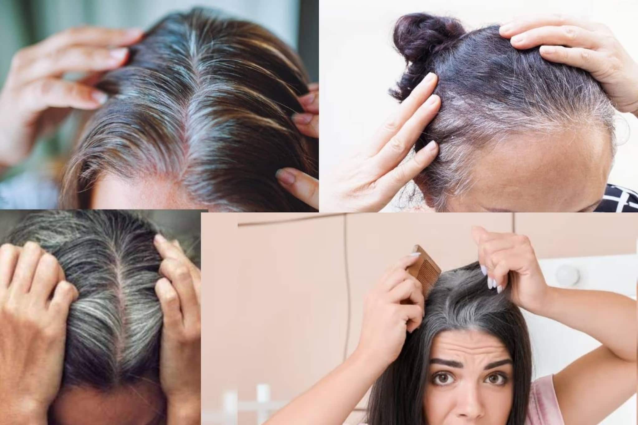 দামি কলপ-কালার ছোঁবেন না! ১ চামচ কালো জিরাতে সাদা চুল হবে মিশমিশে কালো! পাকা চুল থাকবেই না