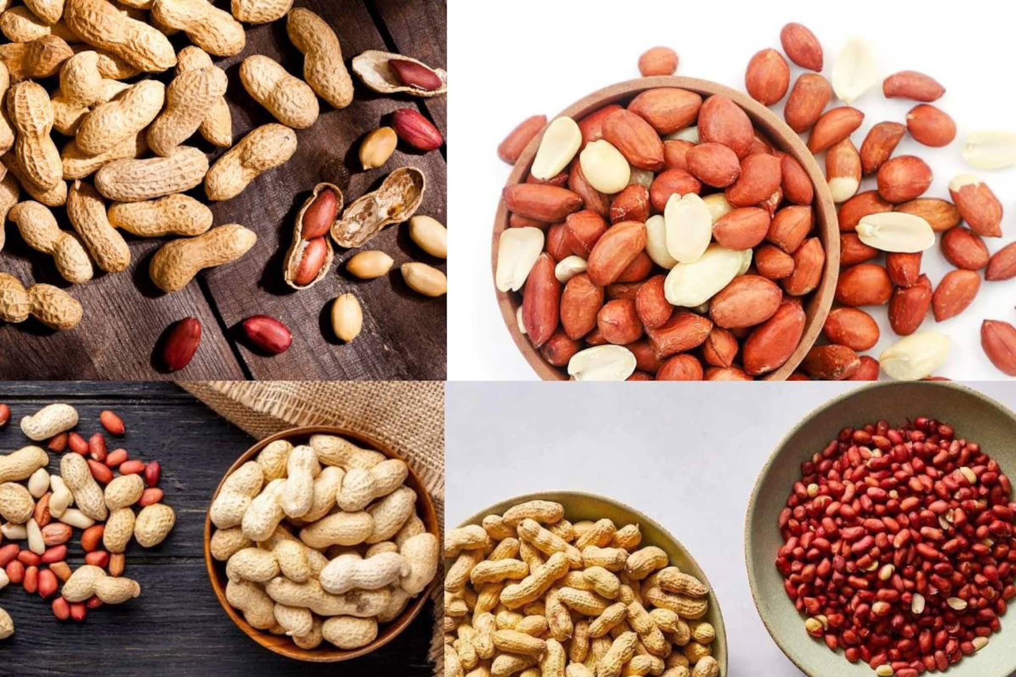 কিডনি স্টোন, ইউরিক অ্যাসিড-সহ কিছু রোগে খাবেনই না চিনেবাদাম! খেলেই বিপদের বাড়বাড়ন্ত!