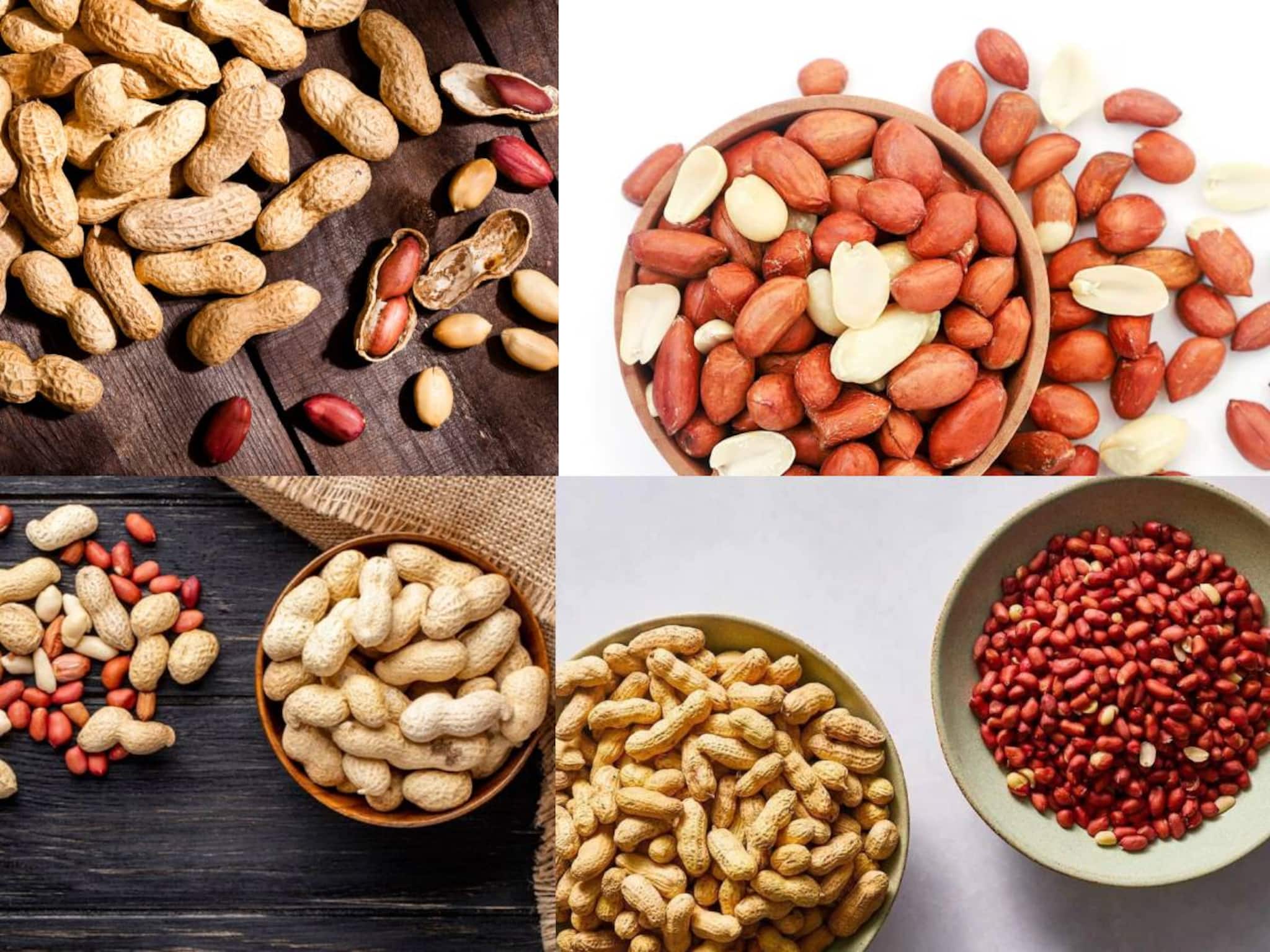 Peanut Side Effects: কিডনি স্টোন, ইউরিক অ্যাসিড-সহ কিছু রোগে দাঁতেই কাটবেন না চিনেবাদাম! খেলেই শরীরে বিপদের বাড়বাড়ন্ত!