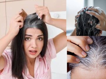 দামি কালার-কলপ গোল্লায় যাক! শ্যাম্পুতে হাফ চামচ আমলকি গুঁড়ো দিলেই কালো হবে পাকা চুল