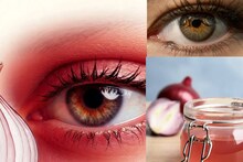 Onion Juice for Eyes: পেঁয়াজের রস দিচ্ছেন চোখে? সারবে কনজাঙ্কটিভাইটিস? নাকি ডেকে আনবে বড় ক্ষতি? জানুন বিশেষজ্ঞের মত