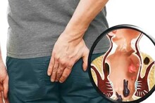 Piles Remedies: ঘি-ত্রিফলার জোড়া বাণ! ওষুধ ছাড়াই পালাবে অর্শ! মুক্তি যন্ত্রণা, রক্তপাত থেকে