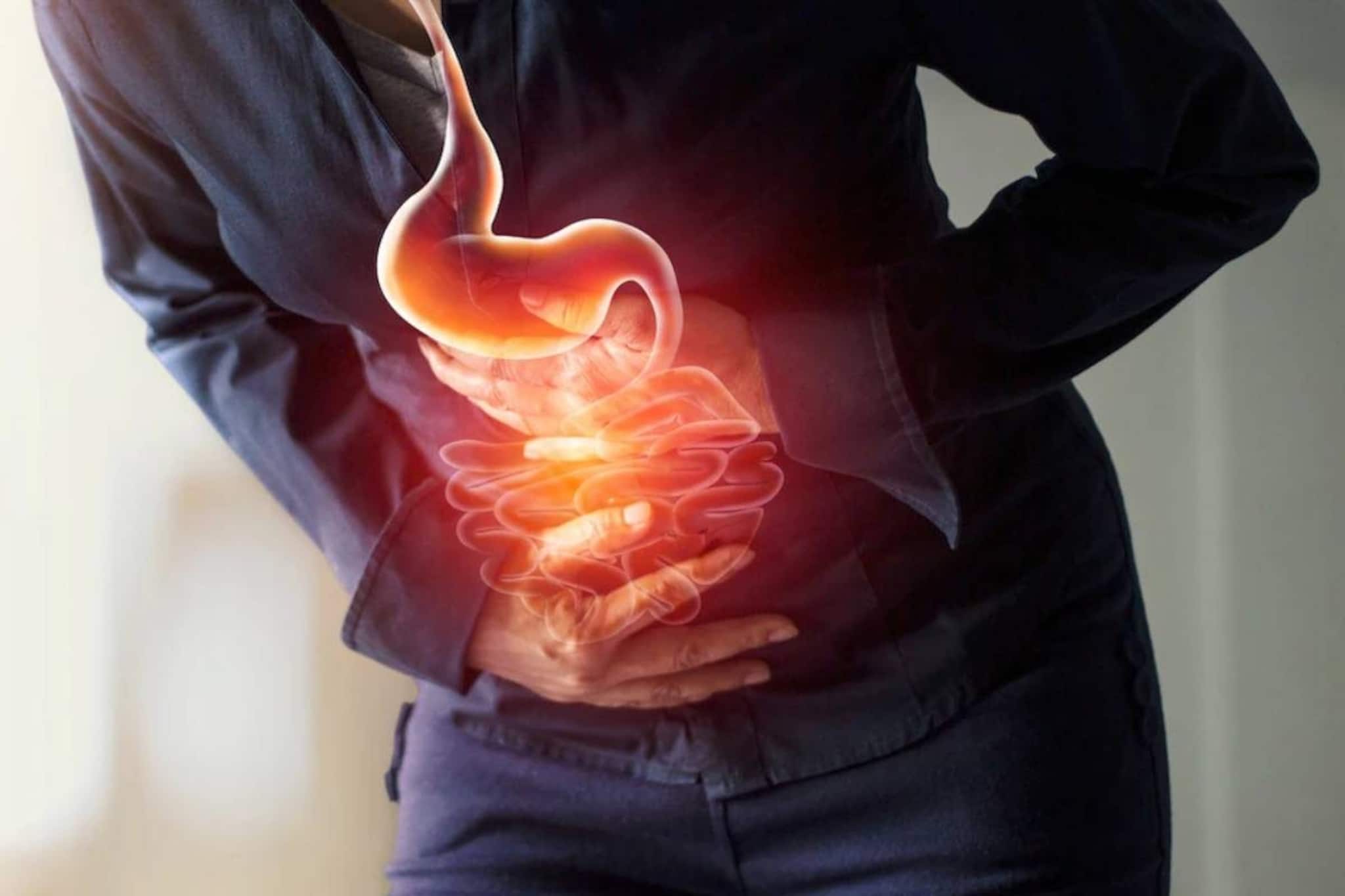 পেটের রোগ সারছেই না? খেয়ে দেখতে পারেন কিছু চেনা সাদা খাবার, মিলতে পারে উপকার