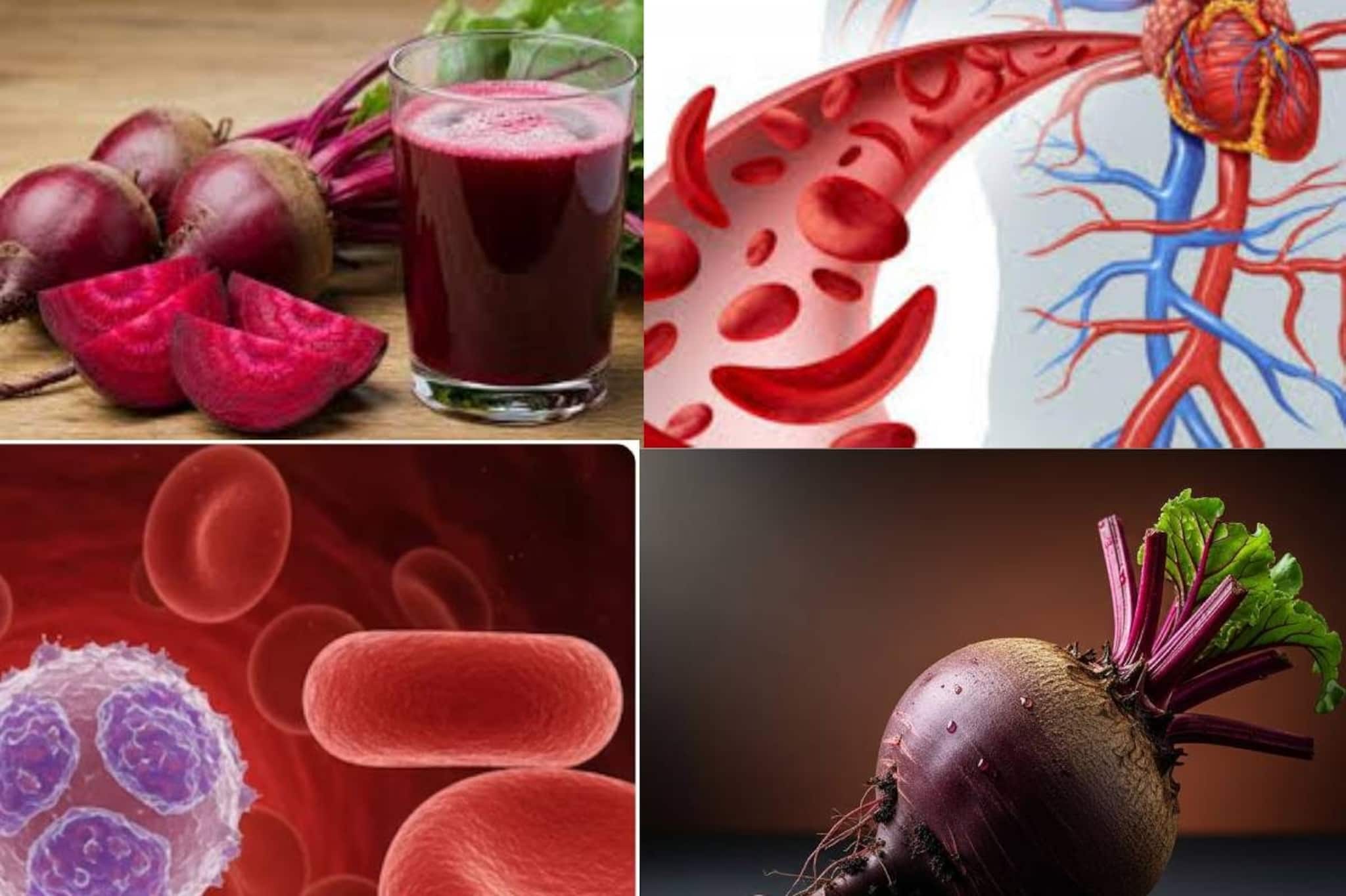 শুধু বিট খেলেই সারবে অ্যানিমিয়া? রক্তাল্পতায় কী খাবেন, কী খাবেন না? জানুন বাঁচার উপায়