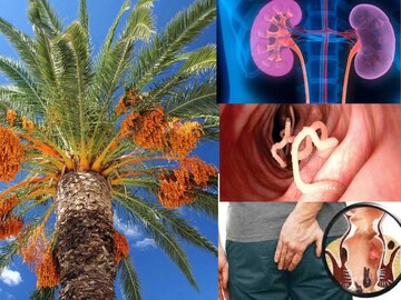 প্রস্রাবের সমস্যা শেষ! কিডনির রোগের ব্রহ্মাস্ত্র! কৃমি অর্শের টোটকা! খেজুরপাতা খান এভাবে