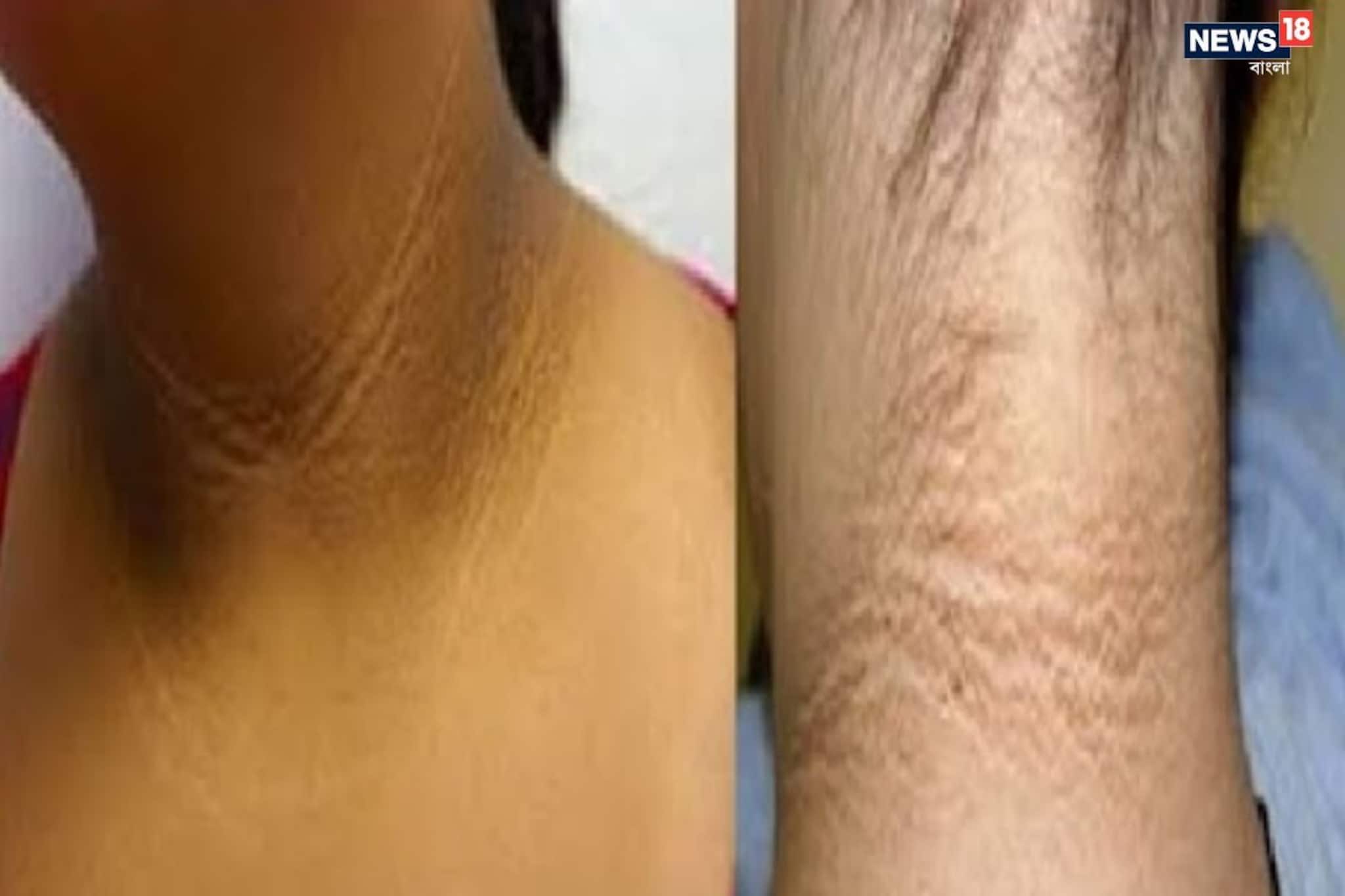 গলার কালো দাগ কি শুধু ময়লা? চিকিৎসকদের মতে হতে পারে শরীরের গুরুতর সতর্ক সংকেত