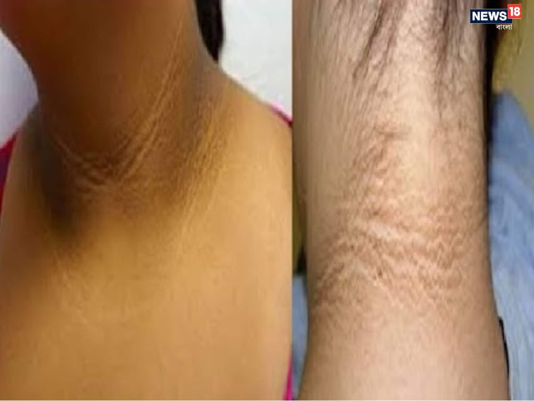 গলার কালো দাগ কি শুধু ময়লা? চিকিৎসকদের মতে হতে পারে শরীরের গুরুতর সতর্ক সংকেত