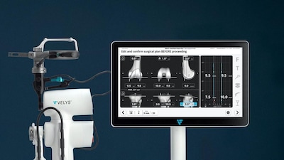 VELYS রোবোটিক সিস্টেমে প্রথম রোবোটিক আংশিক হাঁটু প্রতিস্থাপন, চিকিৎসা পরিষেবায় নজির গড়ল কলকাতা