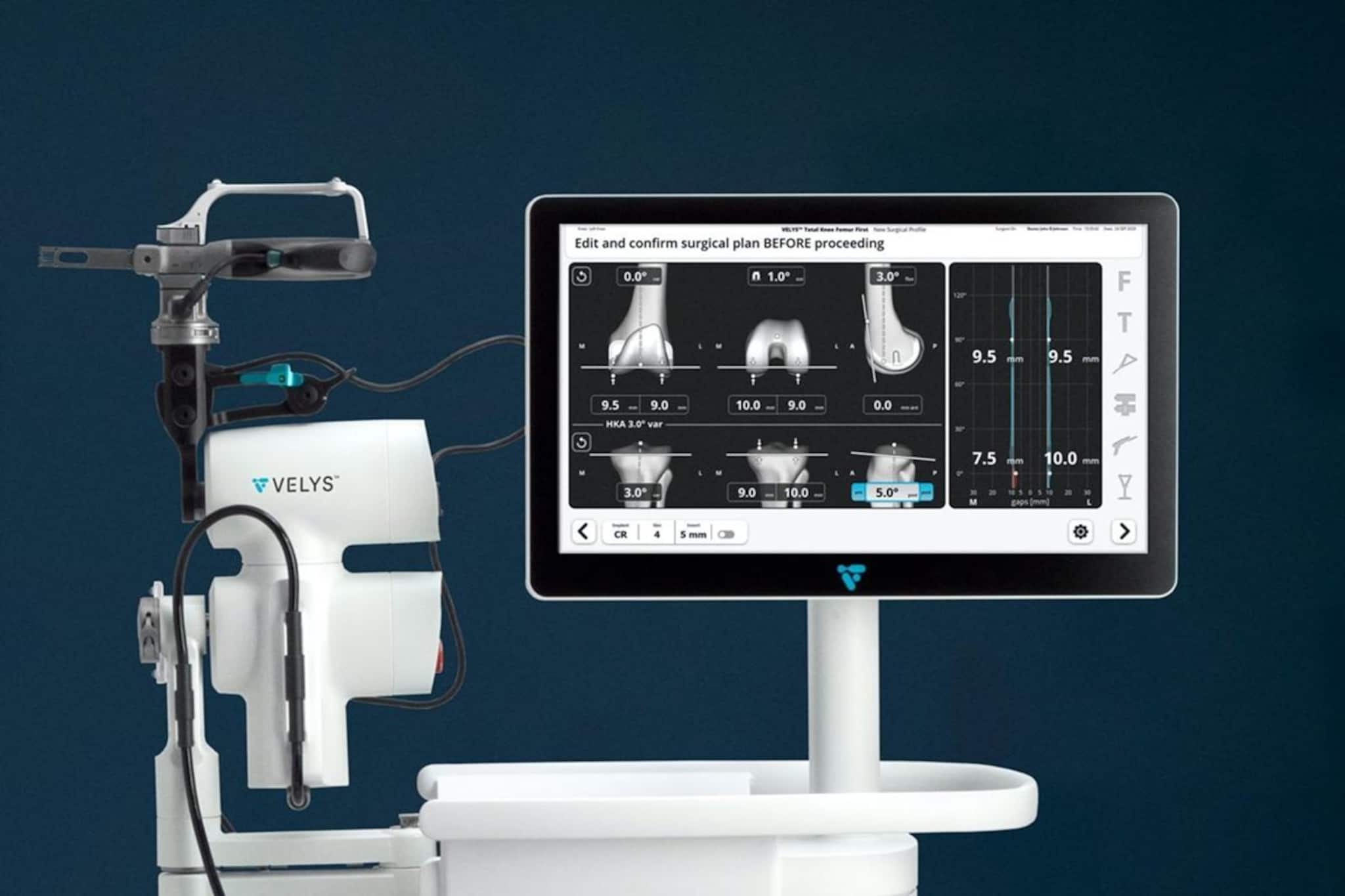 VELYS রোবোটিক সিস্টেমে প্রথম আংশিক হাঁটু প্রতিস্থাপন, চিকিৎসা পরিষেবায় নজির গড়ল কলকাতা