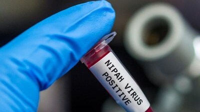 বাদুড় যে ফল খায়, তার থেকে ছড়িয়ে পড়বে এই ভাইরাস৷ বাদুড় যে সব ফল খায়, সেগুলি এড়িয়ে চলুন৷ আধখাওয়া ফল খাবেন না কোনওমতেই৷ বাদুড়ে খাওয়া ফল যদি মিশে থাকে তাজা ফলের সঙ্গে, তাহলেও ছড়াবে সংক্রমণ৷ তাই গাছ থেকে পেড়েই হোক, বা বাজার থেকে কিনেই খান, ফল খাওয়ার সময় সতর্ক থাকুন৷ 