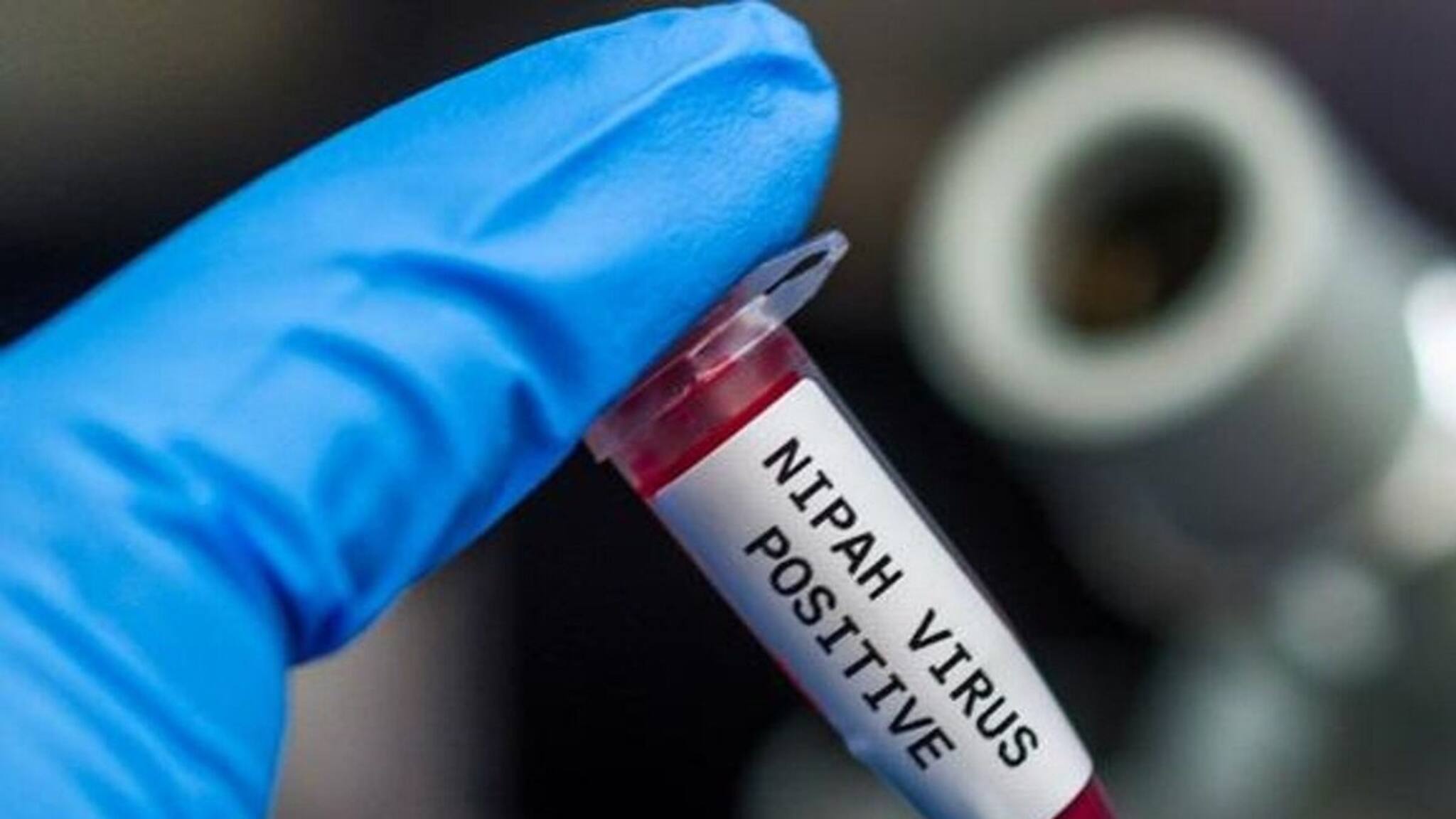 Nipah Virus: সঙ্কটজনক অবস্থা..! ছোঁয়াচে NIPAH Virus-এ আক্রান্ত নার্স, ভর্তি হাসপাতালে, বাড়ছে উদ্বেগ