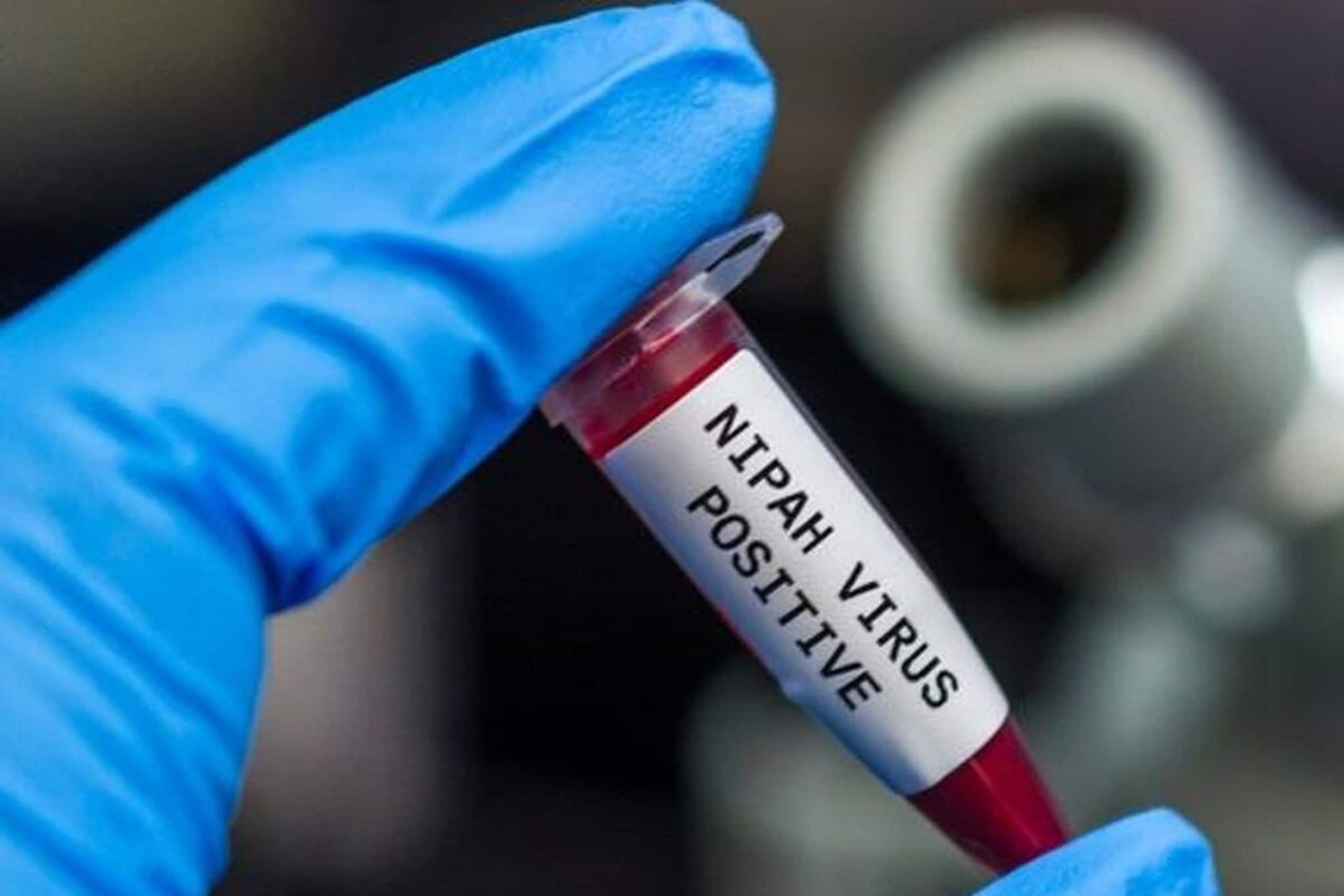 হুড়মুড়িয়ে বাড়ছে...! ভয়ঙ্কর ছোঁয়াচে NIPAH Virus-এ আক্রান্ত নার্স, অবস্থা সঙ্কটজনক!