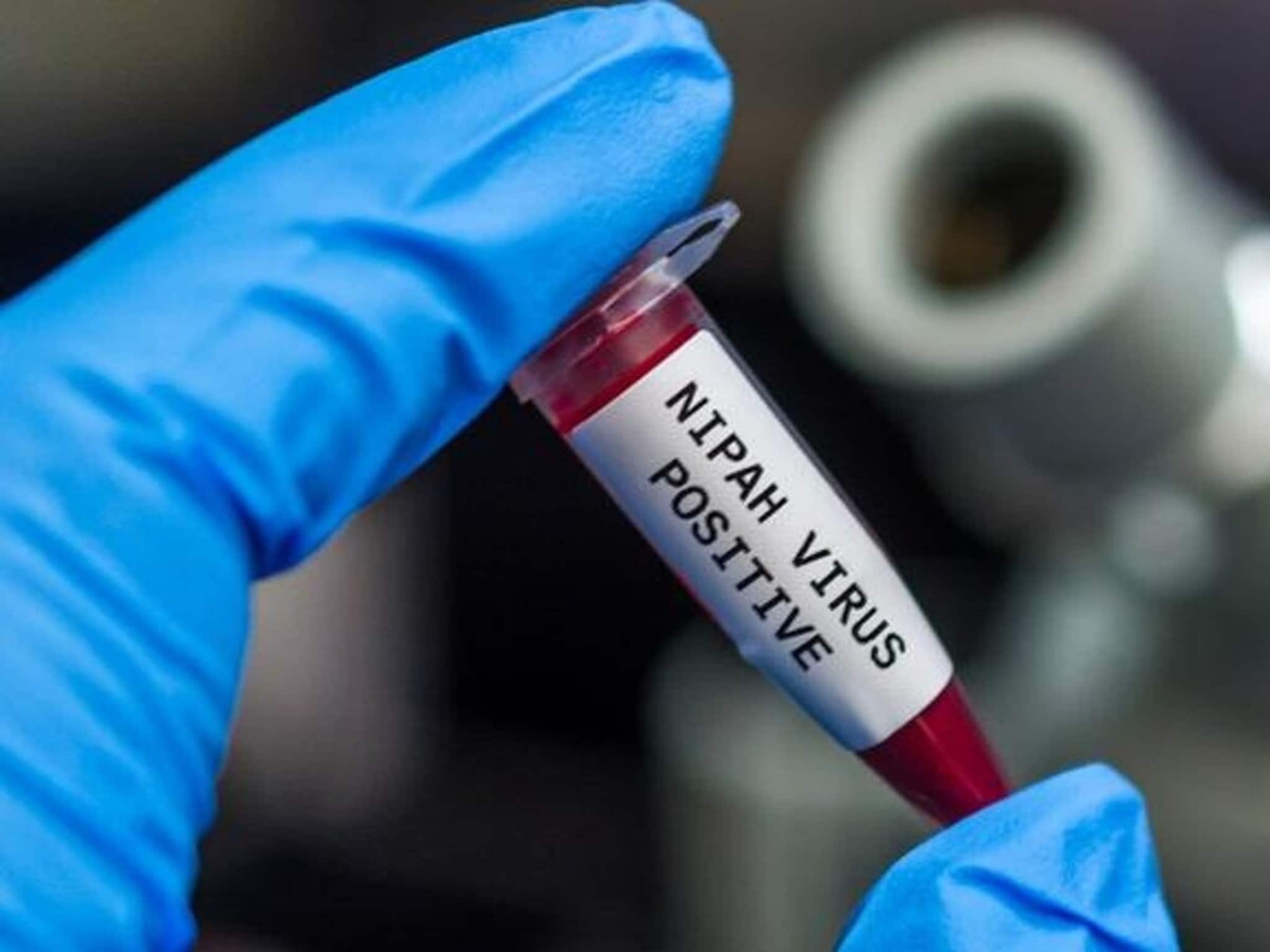 হুড়মুড়িয়ে বাড়ছে...! ভয়ঙ্কর ছোঁয়াচে NIPAH Virus-এ আক্রান্ত নার্স, অবস্থা সঙ্কটজনক!