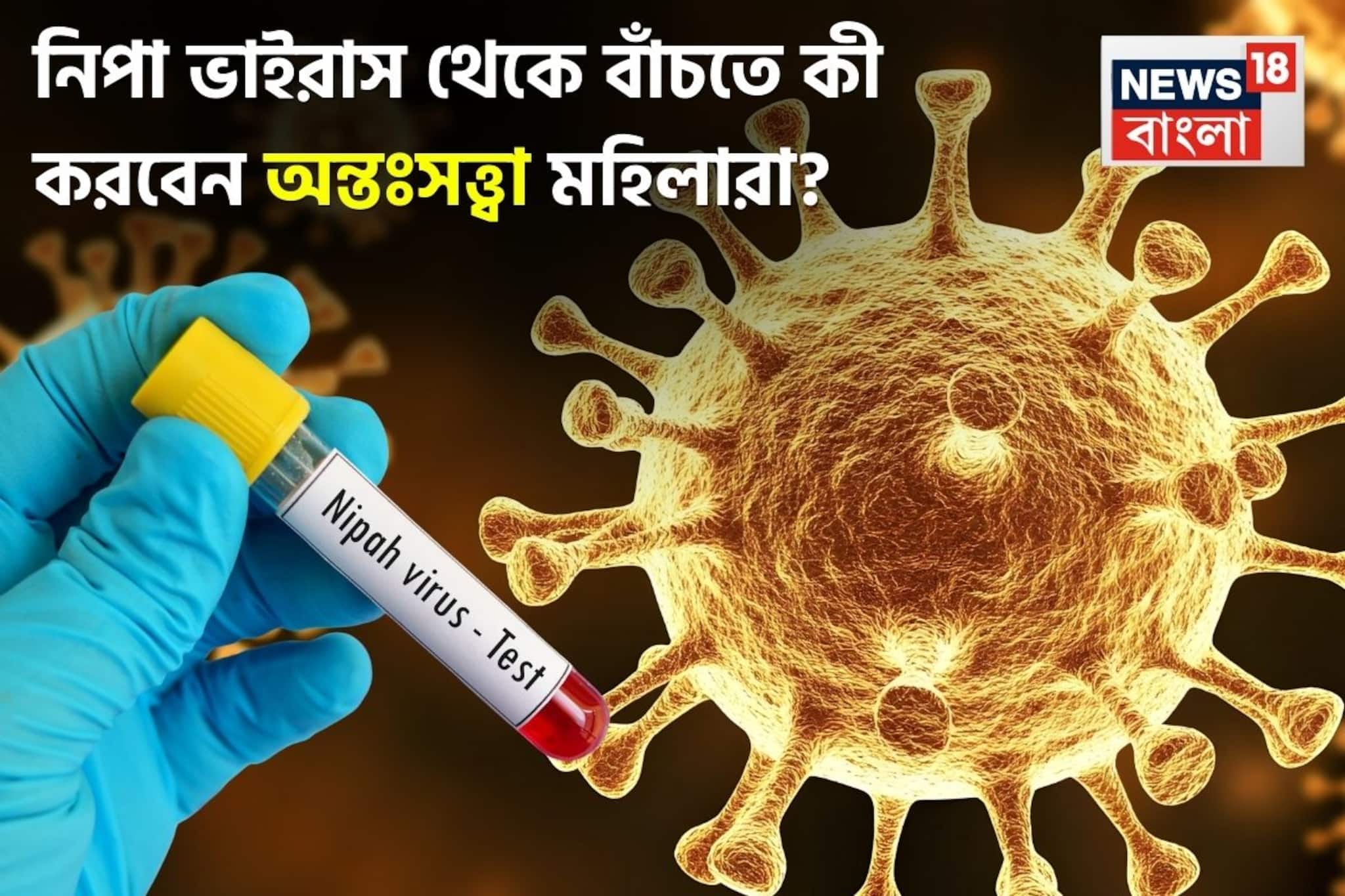 চোখ রাঙাচ্ছে ছোঁয়াচে নিপা ভাইরাস! সংক্রমণ থেকে বাঁচতে কী করবেন অন্তঃসত্ত্বারা? জানুন চোখ রাঙাচ্ছে ছোঁয়াচে নিপা ভাইরাস! সংক্রমণ থেকে বাঁচতে কী করবেন অন্তঃসত্ত্বারা? জানুন