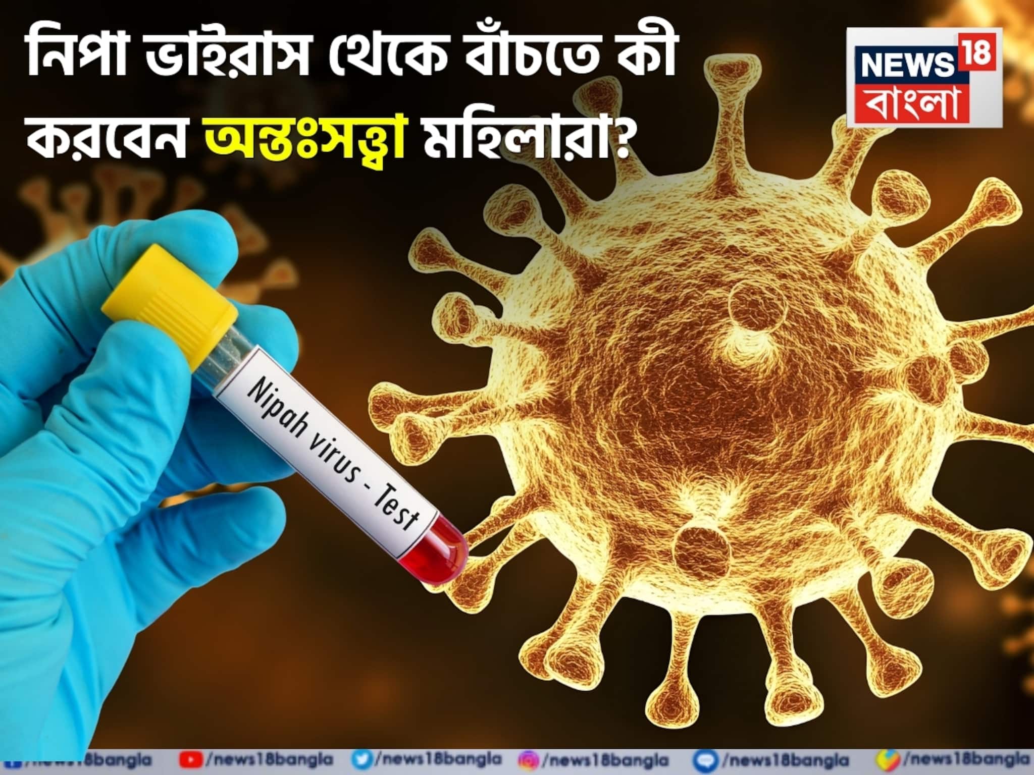 চোখ রাঙাচ্ছে ছোঁয়াচে নিপা ভাইরাস! সংক্রমণ থেকে বাঁচতে কী করবেন অন্তঃসত্ত্বারা? জানুন