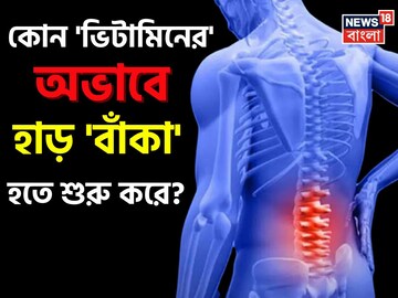 কোন 'ভিটামিনের' অভাবে হাড় 'বাঁকা' হতে শুরু করে বলুন তো...? সঠিক 'উত্তর' জানা জরুরি!