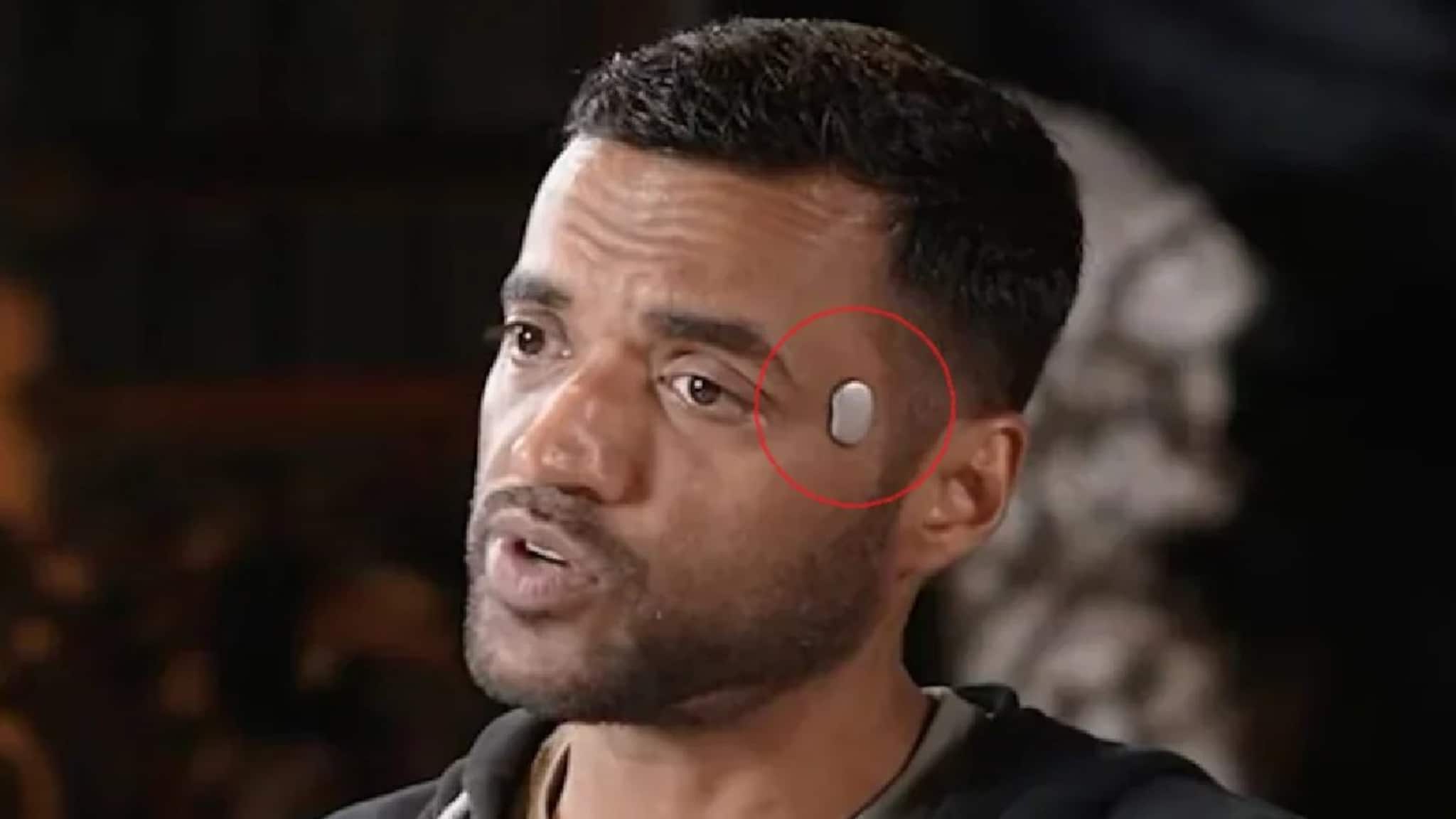 Deepinder Goyal Temple Device : জোম্যাটো সিইও-র কপালের পাশে আশ্চর্যজনক ডিভাইস! যন্ত্রের নাম ‘টেম্পল’, এটির কাজ শুনলে চোখ কপালে উঠবে