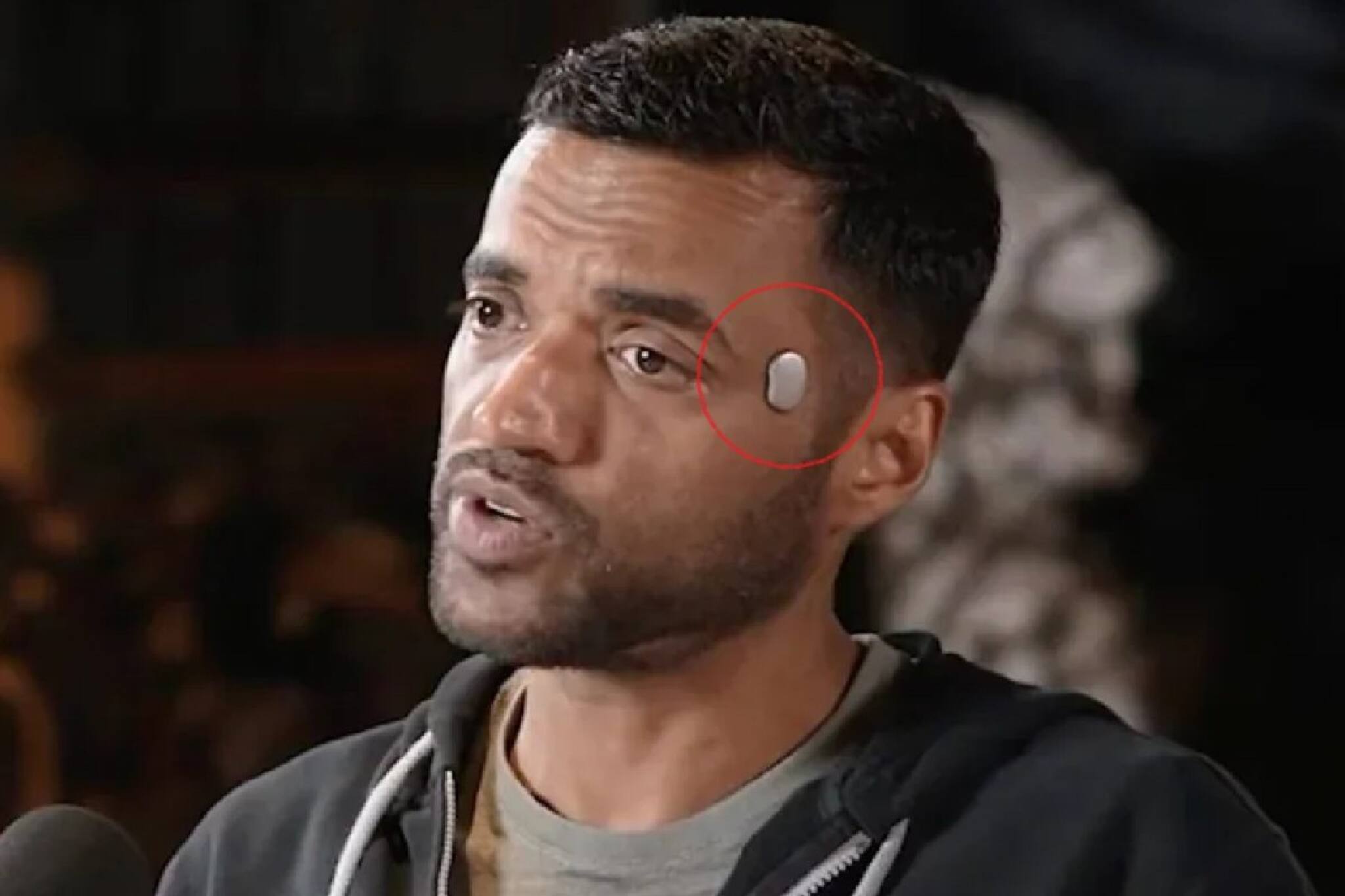 জোম্যাটো সিইও-র কপালের পাশে আশ্চর্যজনক ডিভাইস! যন্ত্রের নাম ‘টেম্পল’, কী কাজ করে?