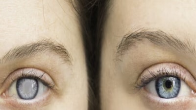 Glaucoma: Not Just for Seniors! Young People at Risk of Vision Loss, Early Detection Key