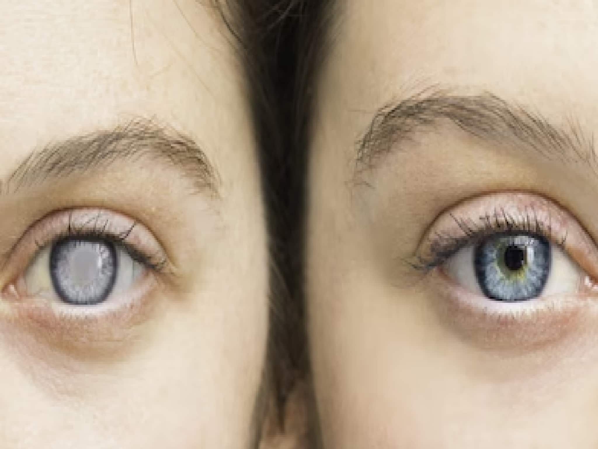 তরুণ বয়সেও গ্লুকোমার ভয়! আগেভাগে ধরা পড়লেই বাঁচতে পারে দৃষ্টিশক্তি, চিনুন লক্ষণ!