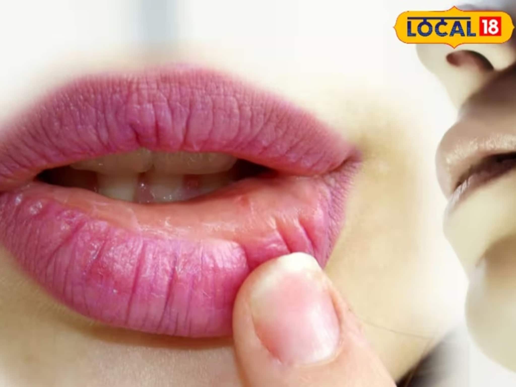 ঠোঁটের রঙেই ধরা পড়ে শরীরের গোপন অসুখ! কী দেখে বুঝবেন, রইল জানার উপায়