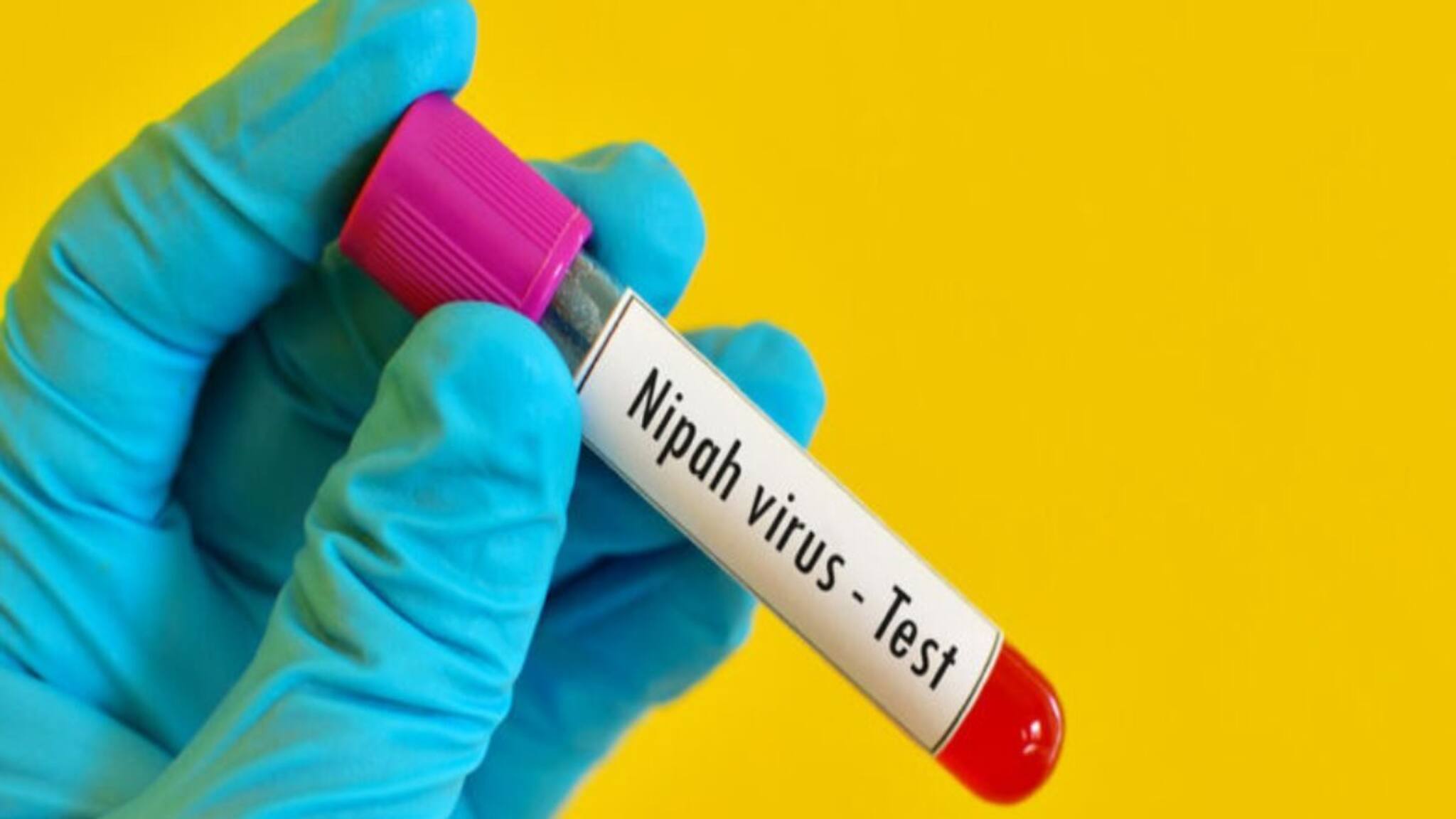 রাজ্যে থাবা বসিয়েছে 'নিপা' ভাইরাস, জরুরি গাইডলাইন জারি রাজ্যের! খুবই গুরুত্বপূর্ণ বিষয়টি জেনে নিন