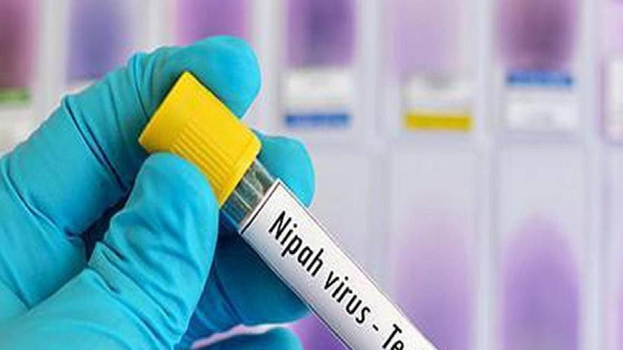 NIPAH: আরও আক্রান্ত বাড়ছে, NIPAH আতঙ্কে জর্জরিত বাংলা, ফের নিপা সন্দেহে বেলেঘাটা আইডিতে ভর্তি নার্স