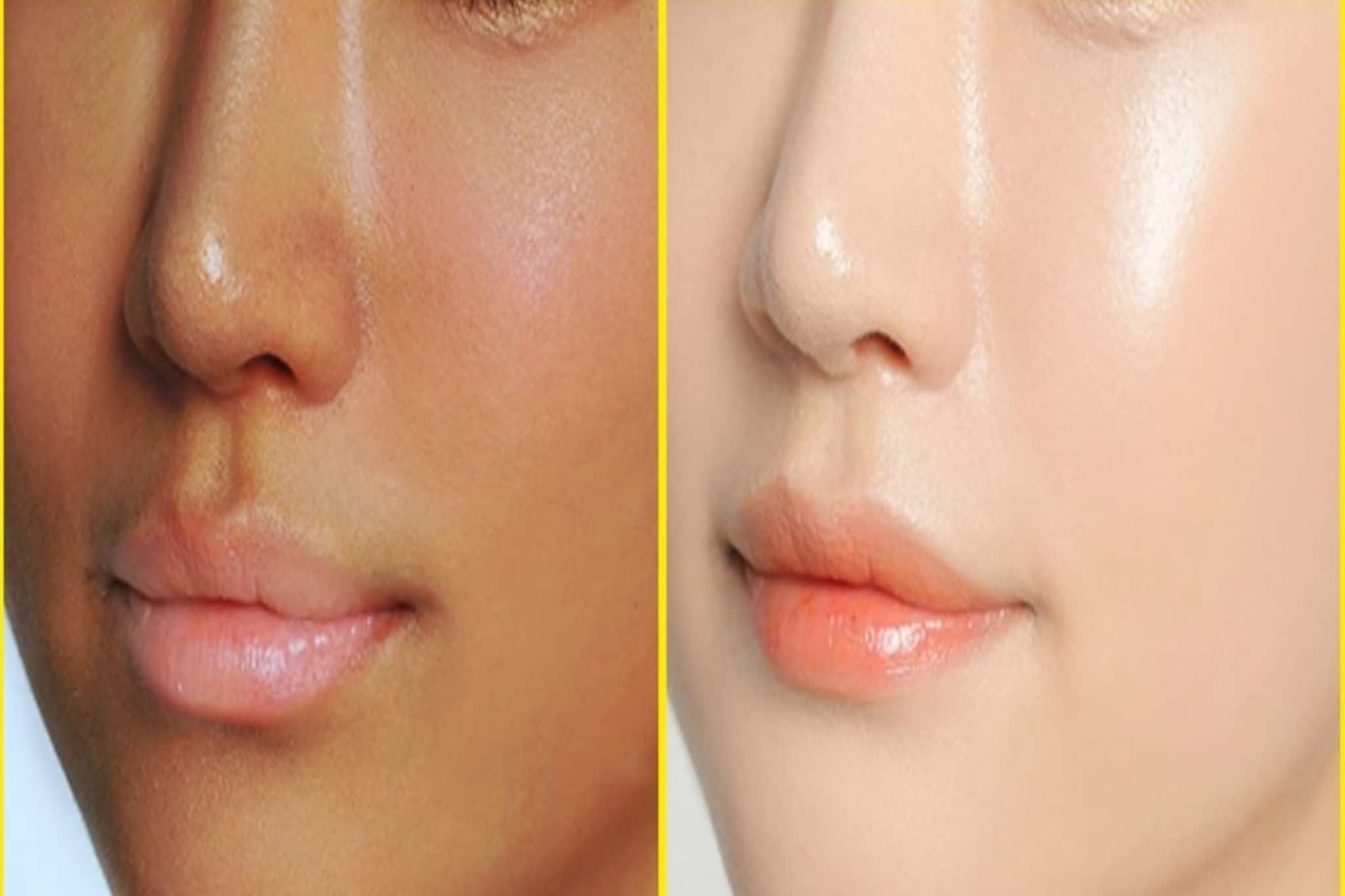 ফুটফুটে হয়ে যাবে মুখ...! রাতে ঘুমোনোর আগে মুখে মেখে নিন এই প্রাকৃতিক 'জিনিস', দেখুন তফাৎ