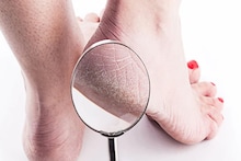 গোড়ালি ফেটে চৌচির...? রাতে নারকেল তেলে মিশিয়ে লাগান ছোট্ট দুই 'জিনিস', সকালেই দেখুন তফাৎ, পা হবে মোমের মতো নরম তুলতুলে!