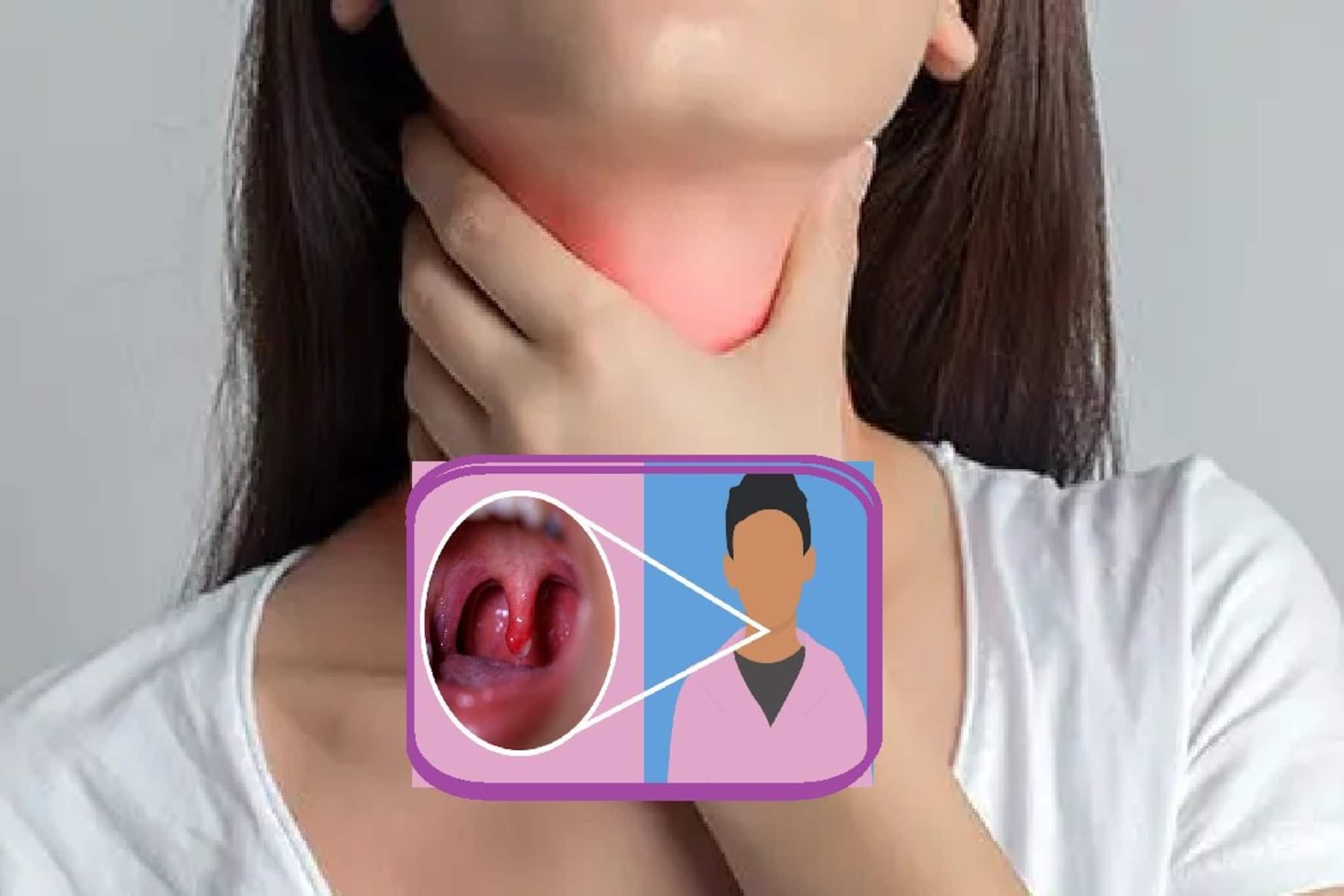 ঠান্ডায় গলাব্যথা, কাঁটার মতো বিঁধছে খচখচ করে, সস্তার এই শীতের সবজি উপড়ে ফেলবে গলার ব্যাথা ঠান্ডায় গলাব্যথা, কাঁটার মতো বিঁধছে খচখচ করে, সস্তার এই শীতের সবজি উপড়ে ফেলবে গলার ব্যাথা